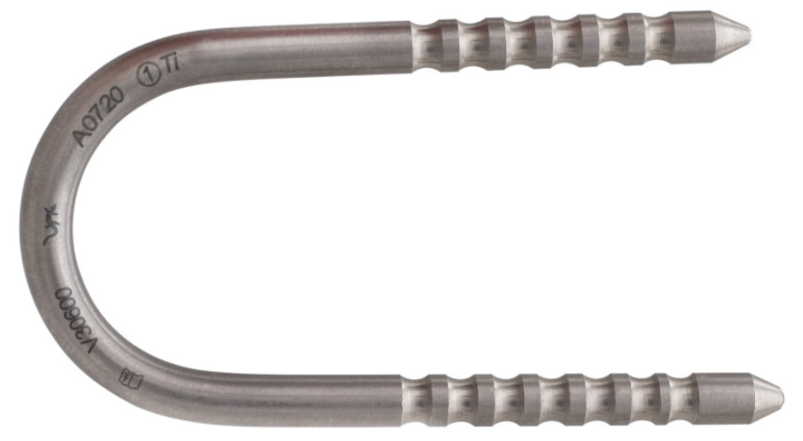 Stainless Steel Twist Leg Glue-In Anchors